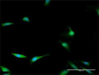 Immunocytochemistry/ Immunofluorescence: MASA Antibody [H00058478-D01P]
