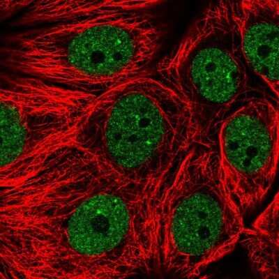 Immunocytochemistry/ Immunofluorescence: MASA Antibody [NBP2-13961]
