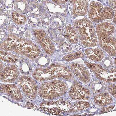 Immunohistochemistry-Paraffin: MASA Antibody [NBP2-13961]