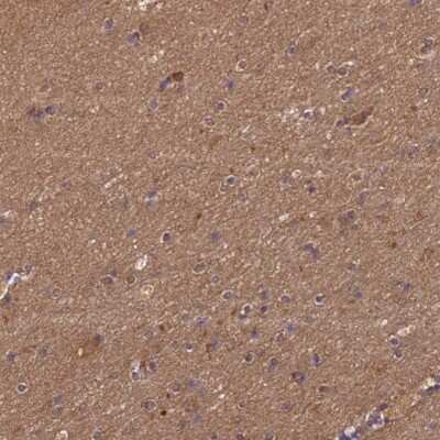 Immunohistochemistry-Paraffin: MASA Antibody [NBP2-13961]