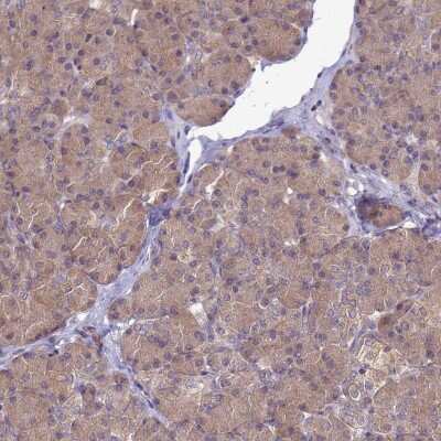 Immunohistochemistry-Paraffin: MASA Antibody [NBP2-13961]