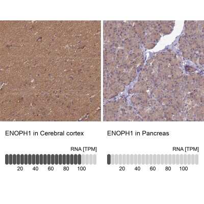Immunohistochemistry-Paraffin: MASA Antibody [NBP2-13961]