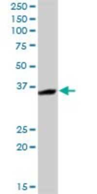 Western Blot: MASA Antibody [H00058478-D01P]
