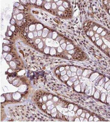 Immunohistochemistry-Paraffin: MASL1 Antibody [NBP2-30382]