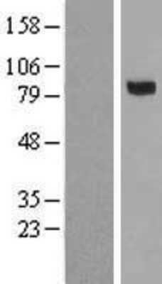 Western Blot: Complement Factor MASP3/MASP1 Overexpression Lysate [NBP2-05611]