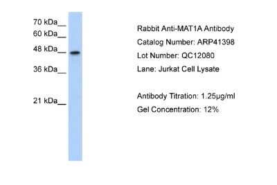 Western Blot: MAT1A Antibody [NBP1-55120]
