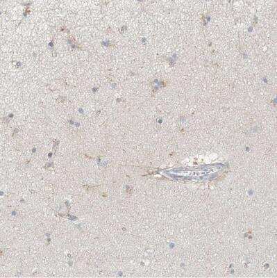 Immunohistochemistry-Paraffin: MAT2B Antibody [NBP1-82797]