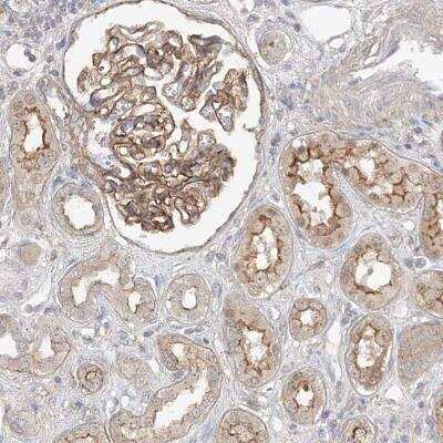Immunohistochemistry-Paraffin: MAT2B Antibody [NBP1-82798]
