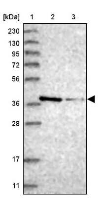 Western Blot: MAT2B Antibody [NBP1-82797]