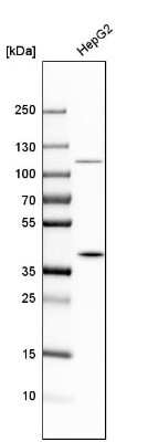 Western Blot: MAT2B Antibody [NBP1-82798]