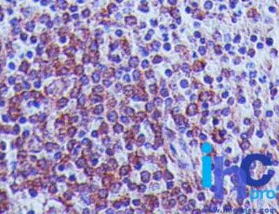 Immunohistochemistry-Paraffin: MAVS Antibody (58N3B6) - BSA Free [NBP2-22380]