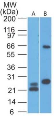 Western Blot: MAVS Antibody (58N3E1) [NBP2-22378]