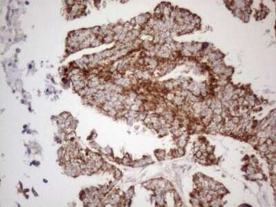 Immunohistochemistry: MAVS Antibody (OTI9C4) [NBP2-45757]