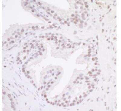 Immunohistochemistry-Paraffin: MAZ Antibody [NB100-86984]