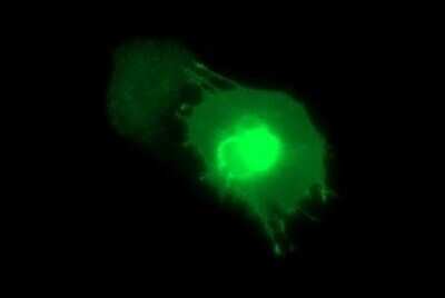 Immunocytochemistry/ Immunofluorescence: MAdCAM-1 Antibody (OTI1A5) - Azide and BSA Free [NBP2-72568]