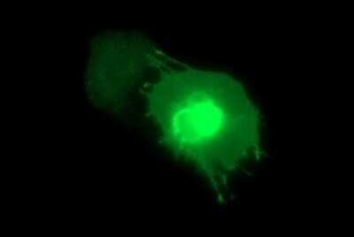 Immunofluorescence: MAdCAM-1 Antibody (OTI1A5) [NBP2-45706]