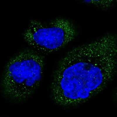 Immunocytochemistry/ Immunofluorescence: MB21D2 Antibody [NBP1-92101]