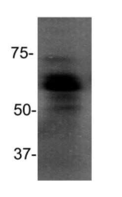 Western Blot: MBD1 Antibody (100B272.1) [NB100-56537]
