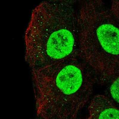 Immunocytochemistry/ Immunofluorescence: MBD1 Antibody [NBP2-68876]