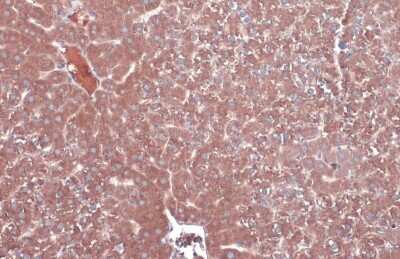 Immunohistochemistry-Paraffin: MBL-2 Antibody [NBP3-13134]