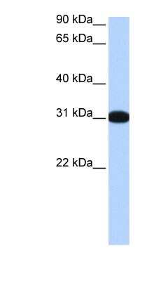 Western Blot: MBNL2 Antibody [NBP1-79451]