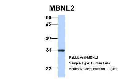Western Blot: MBNL2 Antibody [NBP1-79451]