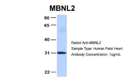 Western Blot: MBNL2 Antibody [NBP1-79451]