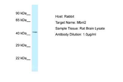Western Blot: MBNL2 Antibody [NBP2-87783]