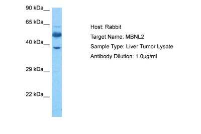 Western Blot: MBNL2 Antibody [NBP2-87784]