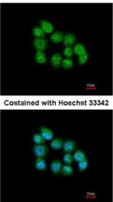 Immunocytochemistry/ Immunofluorescence: MBNL3 Antibody [NBP1-32575]