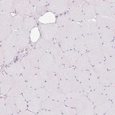 Immunohistochemistry-Paraffin: MBOAT7 Antibody [NBP2-49207]