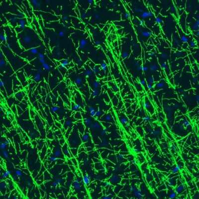 Immunohistochemistry: MBP Antibody (CL2829) [NBP2-46632]