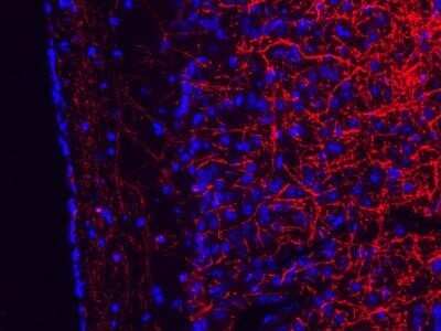 Immunohistochemistry-Frozen: MBP Antibody (2H9) - Azide and BSA Free [NBP2-80844]