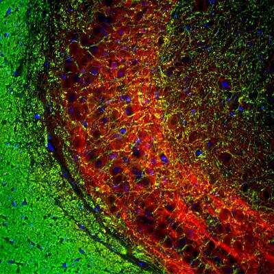 Immunohistochemistry: MBP Antibody (7D2) [NBP1-05204]