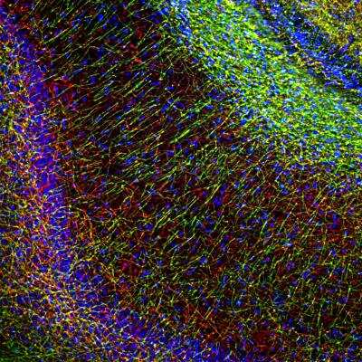Immunohistochemistry: MBP Antibody (7G7) [NBP1-05203]