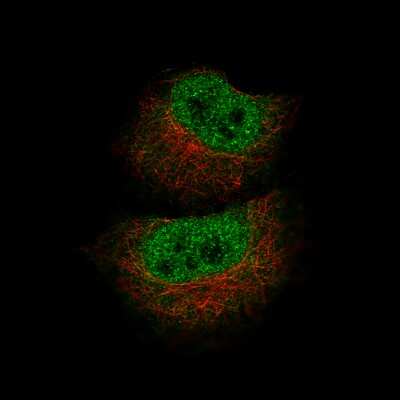 Immunocytochemistry/ Immunofluorescence: MBP Antibody (CL2819) [NBP2-46630]