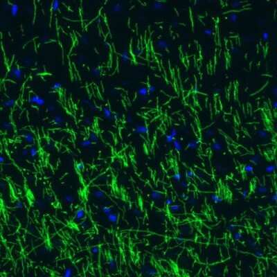 Immunohistochemistry: MBP Antibody (CL2819) [NBP2-46630]