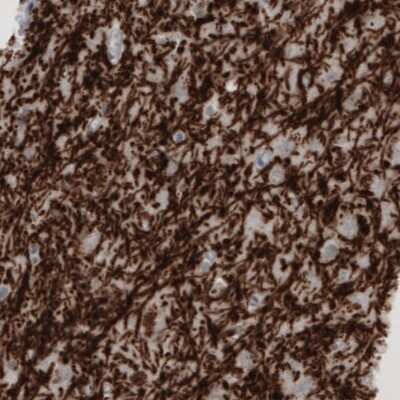 Immunohistochemistry: MBP Antibody (CL2819) [NBP2-46630]
