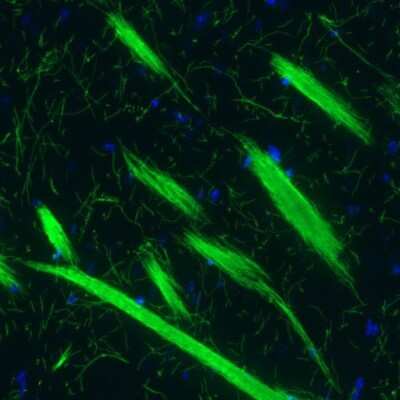Immunohistochemistry: MBP Antibody (CL2819) [NBP2-46630]