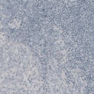 Immunohistochemistry: MBP Antibody (CL2819) [NBP2-46630]