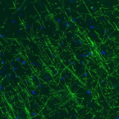 Immunohistochemistry: MBP Antibody (CL2827) [NBP2-46631]