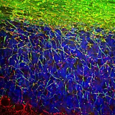 Immunocytochemistry/ Immunofluorescence: MBP Antibody [NBP2-29656]