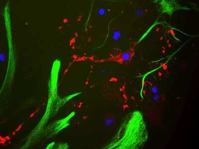 Immunocytochemistry/ Immunofluorescence: MBP Antibody [NBP2-29656]