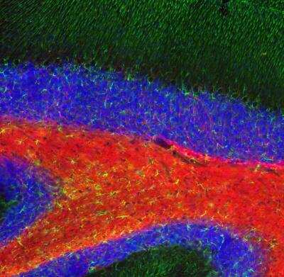 Immunocytochemistry/ Immunofluorescence: MBP Antibody [NBP3-05553]