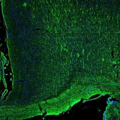 Immunohistochemistry: MBP Antibody [NBP2-33555]