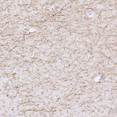 Immunohistochemistry-Paraffin: MBP Antibody [NBP2-33555]