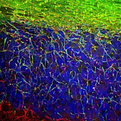 Immunohistochemistry: MBP Antibody [NBP2-50035]