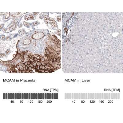 Immunohistochemistry-Paraffin: MCAM/CD146 Antibody (CL12855) [NBP3-18546]