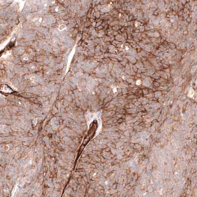 Immunohistochemistry-Paraffin: MCAM/CD146 Antibody (CL12855) [NBP3-18546]