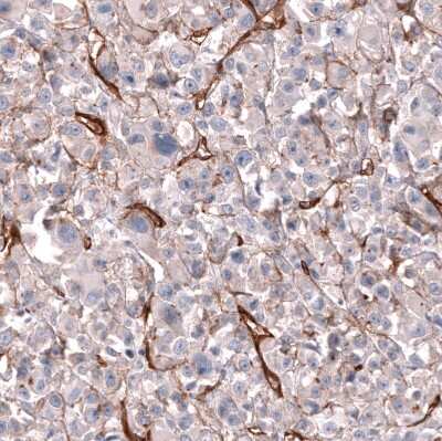 Immunohistochemistry-Paraffin: MCAM/CD146 Antibody (CL12855) [NBP3-18546]